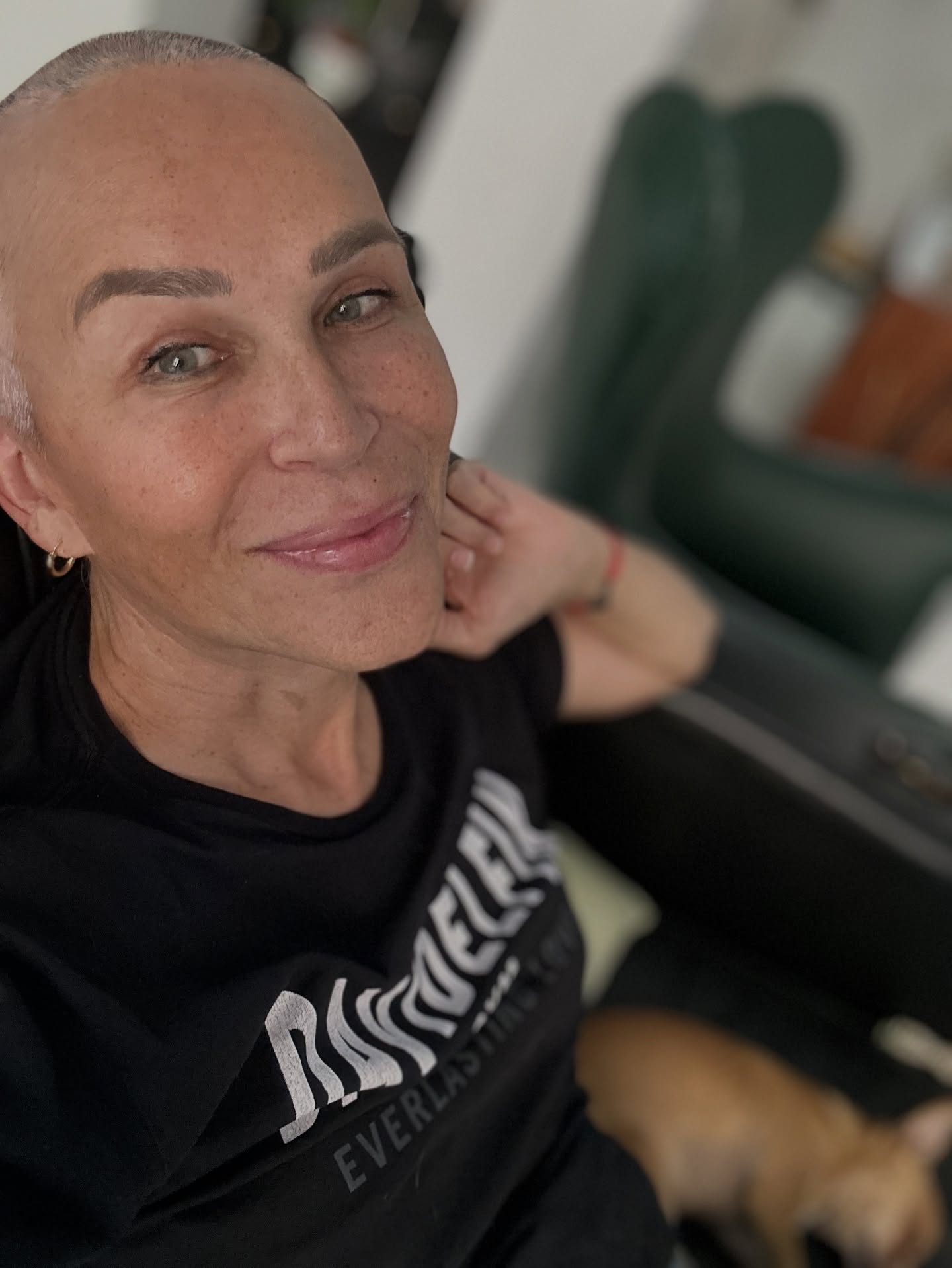 Antonia San Juan, sin pelo debido al cáncer.