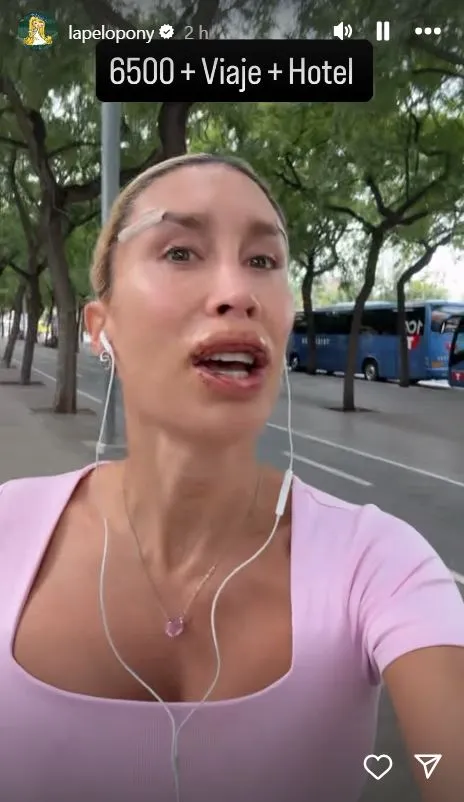 La Pelopony con los labios cosidos tras operarse.