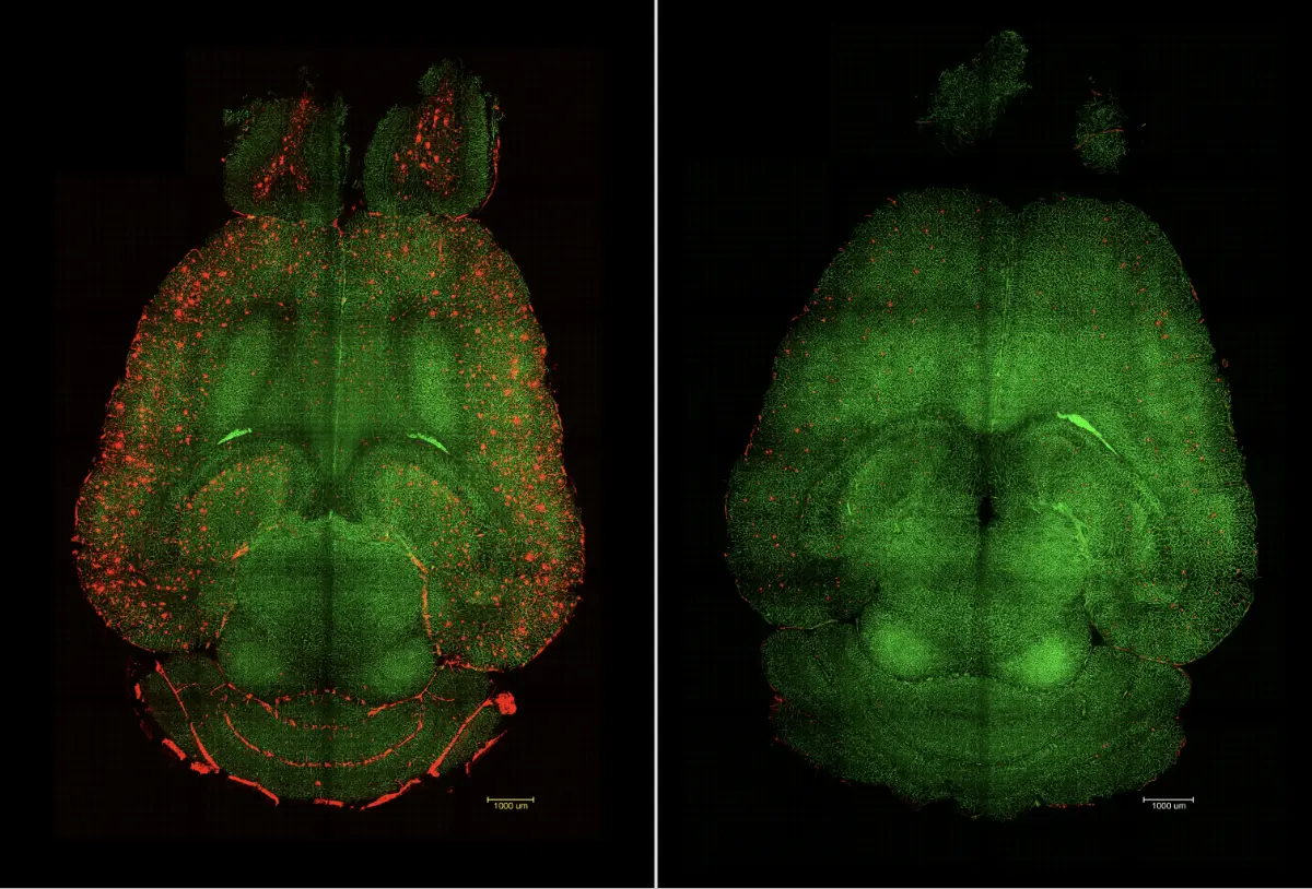 Imágenes del cerebro de un ratón antes y después del tratamiento contra el alzheimer.